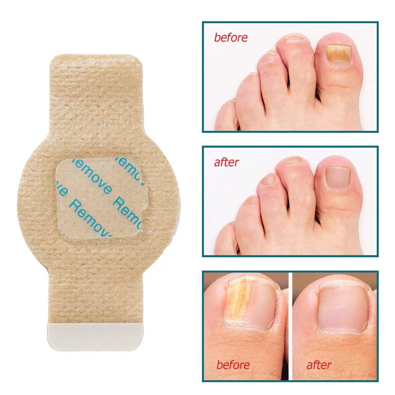 Plovera Hydrogel Nail Protection Patch