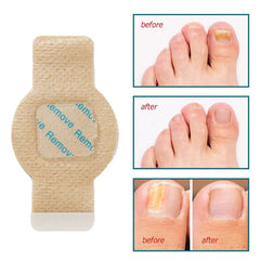 Plovera Hydrogel Nail Protection Patch